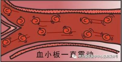 血小板是正常值的三倍？專家提醒小心血栓和出血！