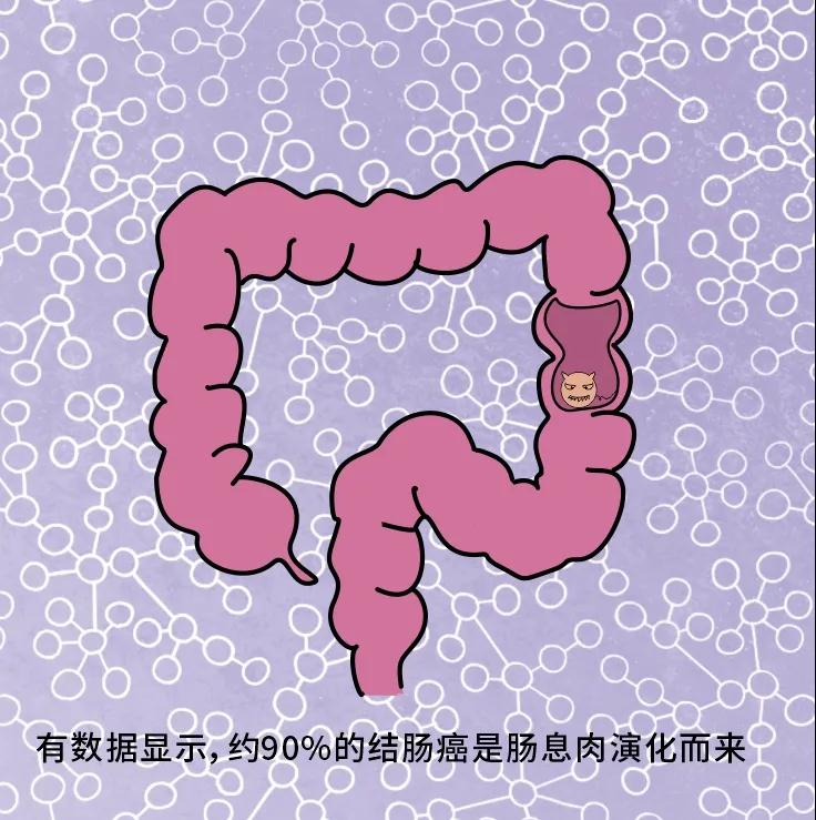 奪走“黑豹”生命的結(jié)腸癌，到底什么來頭？