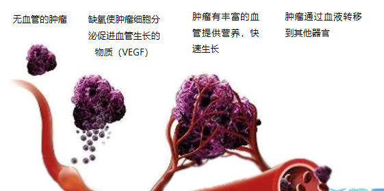 晚期腫瘤為什么會復(fù)發(fā)轉(zhuǎn)移？