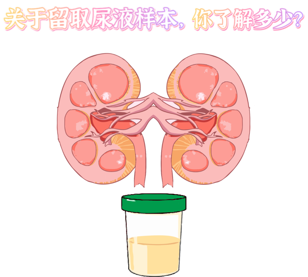 做尿檢，不得不說的注意事項(xiàng)！
