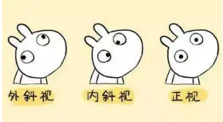 小baby老歪著頭？警惕斜頸! 這樣糾正……