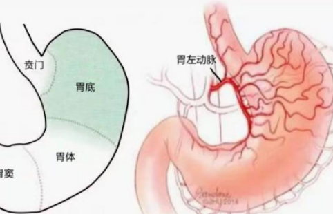 不開刀不吃藥不餓肚子，微創(chuàng)介入減肥靠譜嗎？
