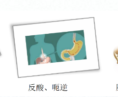 關(guān)愛身體健康，輕松檢查胃腸