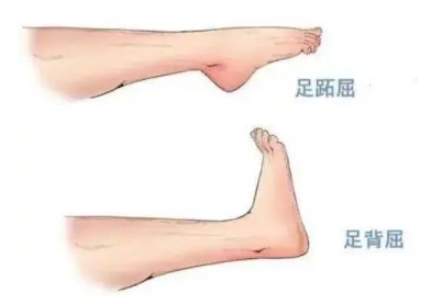 扭胯小連步、動感搖花手……“科目三”雖火，運動損傷也要防！